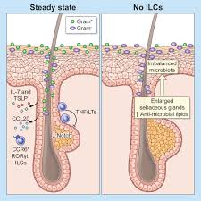 Image result for Sebaceous Gland