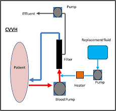 acute kidney injury requiring renal replacement therapy