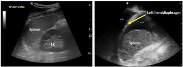 Image result for FAST Exam