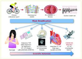 Image result for Exercise Induced Syncope