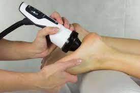  etude observationnelle prospective, visant à évaluer les facteurs prédictifs de bonne réponse aux ondes de choc radiales  materiels et methodes : Traitement De La Tendinite A Paris Par Les Ondes De Choc Jerome Auger