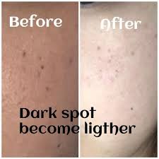Believe it or not, ageing is not to blame for your skin's discolouration, wrinkles and. Prowhite Regimen Prowhite 16 S Uv Bright 16 S