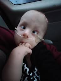 When Baby Xander was diagnosed with Trisomy 18, his parents were told he  would never survive. He did. Xander's family was able to find the care they  needed, and he has since