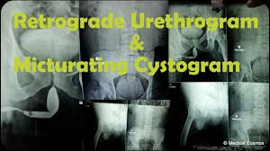 Image result for Retrograde Urethrogram