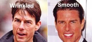Chatter Busy Tom Cruise Plastic Surgery Celebrity Plastic Surgery Plastic Surgery Plastic Surgery Gone Wrong