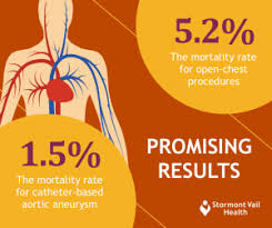 aortic aneurysm repair is catheter based treatment right