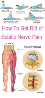 Pin On Sciatic Nerve Pain