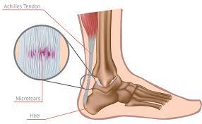 Ini terjadi ketika tulang rawan pada tulang rusuk mengalami peradangan. Beauty Journal Situs Kecantikan Dan Gaya Hidup Andalan Wanita Masa Kini