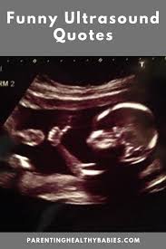 21 Funny Ultrasound Quotes Funny Funny Quotes Quotes