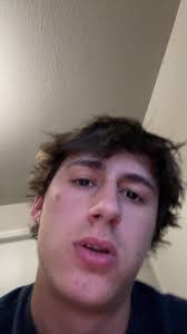 James Johnson Eye Looking Up