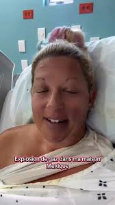 Accident au Mexique, Je suis brûlée au 2e degré , Je vous avez dit qu'il  m'arrivait toujours des péripéties., Et bien celle là bas toutes les autres  , #mexique #hopital #assurancevoyage #brule2edegre ...