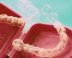 Clareamento Dental Perfeito Dentes Brancos Clareamento Dental Dental Dentes Brancos