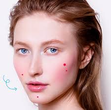 How to treat acne rosacea language:de. Papulopustular Rosacea How To Treat Your Acne Rosacea Breakouts