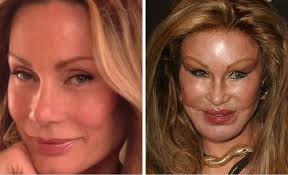 Find out which plastic surgery procedures are performed most often. Celebs Photos Most Shocking Top 5 Plastic Surgery Nightmares Jiji Blog
