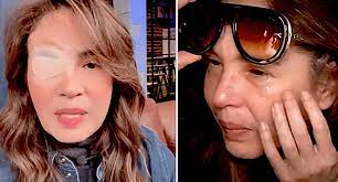 Yolanda Andrade tendría bacteria en la sangre; sigue delicada y no puede  trabajar