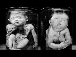 Ã§ernobil ile ilgili gÃ¶rsel sonucu