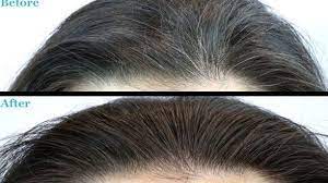 Pin On Whate Hair