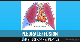 Diagnostic methods in pleural tuberculosis. Pin On Nurse Stuff