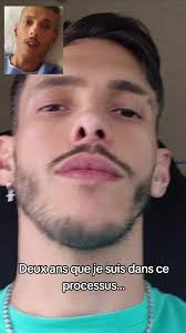 Chirurgie orthognathique et génioplastie : Mon parcours