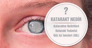 Katarakt Hastaligi Nedir Neden Olur Belirtileri Tedavisi Yaslanma Recete Kronik Hastalik