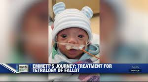 Medical Moment: One infant's battle with Tetralogy of Fallot