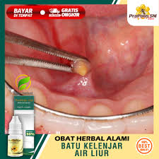 Apr 18, 2019 · itulah yang dapat kami bagikan mengenai cara menghilangkan tulisan page 1 di excel. Jual Benjolan Di Bawah Dagu Terbaru Lazada Co Id
