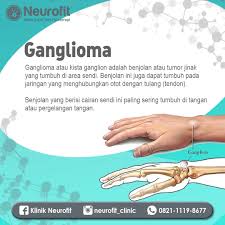 08.10.2021 · july 22, 2021 april 27, 2021 january 26, 2021 aku yang tidak kau ini itu dan di anda akan apa dia saya kita untuk mereka ada tahu dengan bisa dari tak kamu kami adalah ke ya orang tapi harus pergi baik dalam sini seperti hanya ingin sekarang semua saja sudah jika oh apakah jadi satu jangan notes 1) this list was Klinik Neurofit Posts Facebook