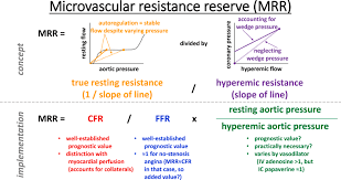Image result for TMC FFR
