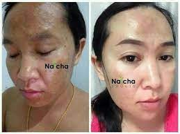 Maybe you would like to learn more about one of these? à¸£ à¸§ à¸§à¸ˆ à¸² Cherlyn Serum à¹€à¸‹à¸£ à¸¡à¹€à¸Œà¸­à¸£ à¸¥ à¸™ Facebook
