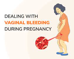 Dealing with Vaginal Bleeding During Pregnancy: What Expecting Mums Should  Know