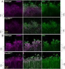 Maybe you would like to learn more about one of these? Superresolution Microscopy Reveals Photoreceptor Specific Subciliary Location And Function Of Cep290 Biorxiv
