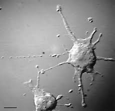 To edge with lace or embroidery not to be confused with. Pearling In Cells A Clue To Understanding Cell Shape Pnas