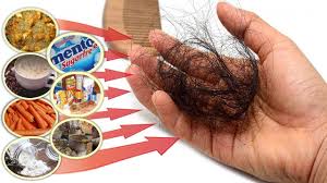 Foods that can lead to thinning hair and hair loss. These Foods That Cause Hair Loss Avoid These Bad Foods To Stop Losing Hair Youtube