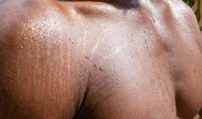 Exercise (particularly weightlifting) can boost the blood flow in the shoulder area, which stimulates faster cell turnover. Men S Skin Care Blog Tips Page 20 Tiege Hanley