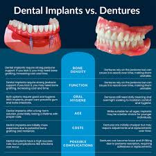 Image result for dentures