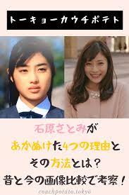 石原さとみが垢ぬけた4つの理由と方法とは 昔と今の画像比較で考察 ビフォーアフター ダイエット 有名人の整形手術 垢抜け