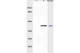 Prostaglandin e 2 (pge2), also known as dinoprostone, is a naturally occurring prostaglandin with oxytocic properties that is used as a medication. Rabbit Anti Human Pge2 Antibody Abin748403