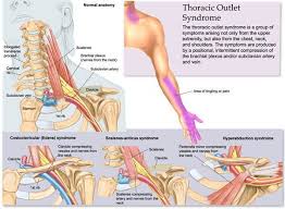 Scalene Muscles Are Three Paired Muscles Of The Neck Located In The Front On Either Side Of The Throat Just Lateral Massage Therapy Thoracic Physical Therapy