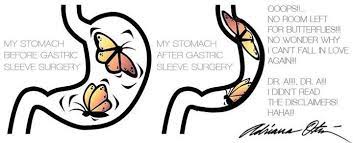 Search, discover and share your favorite funny memes gifs. Vsg Humor Vertical Sleeve Gastrectomy Vertical Sleeve Gastrectomy Sleeve Gastrectomy Sleeve Surgery