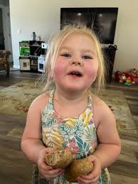 Young woman's transformation after extreme diet