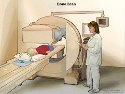 The colon is the final part of the digestive tract. Childhood Colorectal Cancer Treatment Pdq Patient Version National Cancer Institute