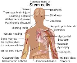 A general increase in the bulk of a body part or organ that is due to an increase in the size, but not in the number, of cells in the tissues. Importance Of Stem Cells Stem Cells University Of Nebraska Medical Center