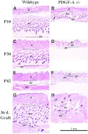 Cancer histology merkel cells histology skin. Histology Of Pdgf A Skin Hematoxylin Erythrosin Staining Of Skin Download Scientific Diagram