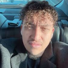 Old news 🙄 he doesn't look like this anymore!