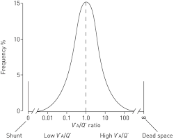 Calculating physiological dead space using the bohr's method. Dead Space The Physiology Of Wasted Ventilation European Respiratory Society