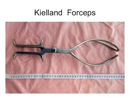 The baby rotating back to a malposition following manual rotation Instrumental Delivery