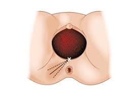 Check 'innere schamlippe' translations into english. Damm Anatomie Funktion Beschwerden Krank De