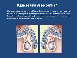 La vasectomía no brinda una protección inmediata contra el embarazo. Que Sabes De La Vasectomia Ppt Video Online Descargar