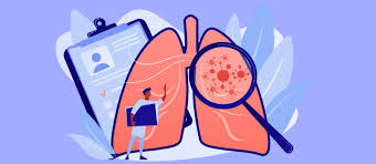 When tumors develop in the lungs, it's known as lung cancer and there are several causes. Causes Of Lung Cancer In Non Smokers