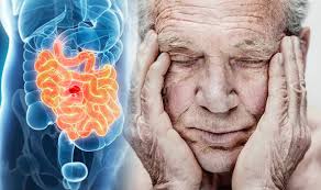 It occurs both in men and in women. Bowel Cancer Symptoms Signs The Disease Has Advanced Express Co Uk
